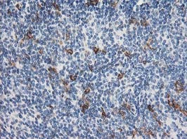 ab123855, at 1/150 dilution, staining Apc2 in paraffin-embedded Human lymphoma tissue by Immunohistochemistry.