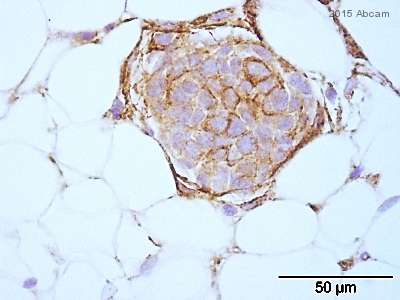 ab123855 staining Apc2 in mouse mammary tissue sections by Immunohistochemistry (IHC-P - paraformaldehyde-fixed, paraffin-embedded sections). Tissue was fixed with formaldehyde and blocked for 1 hour at room temperature; antigen retrieval was by heat mediation. Samples were incubated with the primary antibody (1/150) for 20 hours at 4°C. A Biotin-conjugated anti-mouse IgG polyclonal (1/250) was used as the secondary antibody.See Abreview