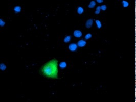ab123855, at 1/100 dilution, staining Apc2 in COS7 cells transiently transfected by pCMV6-ENTRY Apc2 by Immunofluorescence.