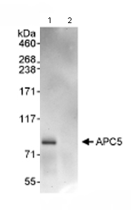 Immunoprecipitation/ Western Blot of Apc5. Lane 1: ab72516 at 3µg/mg Hela whole cell lysate (1mg for IP, 20% of IP loaded). Lane 2: Control IgG. ab72516 at 1µg/ml for WB. Chemiluminescence with an exposure time of 1 minute.