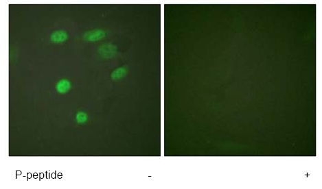 Immunofluorescence analysis of HeLa cells, using ab61075 at 1/500 dilution with or without phospho peptide.
