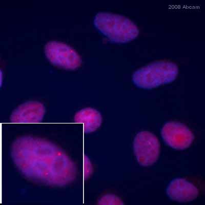 ab194 staining cultured human HeLa cells by ICC/IF.  Cells were PFA fixed and permeabilized in 0.5% Triton X100 prior to blocking in 5% BSA for 1 hour at 20°C.  The primary antibody was diluted 1/200 and incubated with the sample for 1 hour at 20°C.  A Cy3® conjugated donkey anti-mouse antibody diluted was used as the secondary.See Abreview