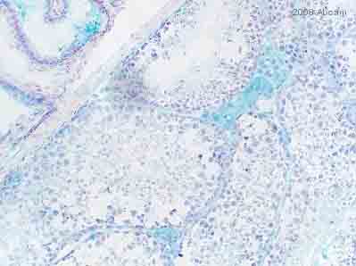 ab64227 staining mouse Testis tissue sections by immunohistochemistry (Frozen sections). Tissue was fixed in paraformaldehyde and blocked in 1% serum for 10 minutes at   20°C. The primary antibody was diluted 1/800 and incubated with sample for 20 hours at 20°C. The biotin conjugated goat polyclonal to rabbit IgG, diluted 1/500 was used as secondary.See Abreview