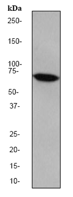 Anti-Apg7 antibody [EP1759Y] (ab52472) at 1/500000 dilution + Jurkat cell lysate at 10 µgSecondarygoat anti-rabbit HRP labeled at 1/2000 dilution