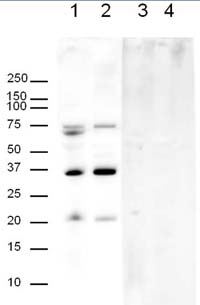 All lanes : Anti-APH1a antibody (ab12104) at 1/500 dilutionLane 1 : 20ug human brain lysateLane 2 : 20ug mouse brain lysateLane 3 : 20ug human brain lysate with Human APH1a peptide (ab12394) at 1 µg/mlLane 4 : 20ug mouse brain lysate with Human APH1a peptide (ab12394) at 1 µg/mlSecondaryGoat Anti-Rabbit IgG H&L (HRP) preadsorbed (ab7090) at 1/5000 dilutionPerformed under reducing conditions.