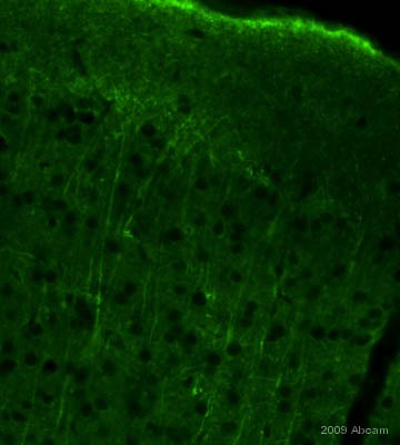 ab12104 staining APH1a in mouse brain tissue section (cortex) by Immunohistochemistry (PFA perfusion fixed frozen sections). Tissue from 4% PFA perfused animals underwent overnight fixation in 4% paraformaldehyde, cryoprotected in 30% sucrose and cut using cryostat.The primary antibody was diluted, 1/1000 (PBS + 0.3% Triton X100) and incubated with sample for 18 hours at 20°C. An abcam antibody ab60314, Chromeo488 conjugated goat polyclonal to rabbit IgG, diluted 1/1000 was used as secondary. ab12104 produces a very pretty staining in neuronal processes in the cortex and the hippocampus. See Abreview