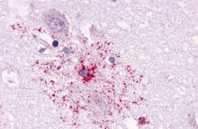 Immunohistochemical analysis of formalin fixed, paraffin embedded Human brain, astrocyte tissue labelling APJ Receptor with ab140508 at 4 µg/ml.