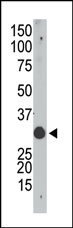 Anti-APOBEC1 antibody (ab38601) at 1/100 dilution + mouse small intestine tissue lysate
