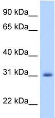 Anti-APOBEC2 antibody (ab51000) at 1.25 µg/ml + Fetal muscle lysate at 10 µgSecondaryHRP conjugated anti-Rabbit IgG at 1/50000 dilution