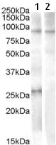 All lanes : Anti-APOBEC2 antibody (ab77589) at 1 µg/mlLane 1 : Human heart lysate (in RIPA buffer)Lane 2 : Human heart lysate (in RIPA buffer) with immunizing peptideLysates/proteins at 35 µg per lane.