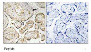 Immunohistochemistry analysis of paraffin-embedded human placenta tissue using 1/50 ab74205.Left image: no pre-treatment.Right image: pre-treatment with immunizing peptide.
