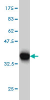 Western blot against tagged recombinant protein immunogen using ab58216 ApoER2 antibody at 1ug/ml. 