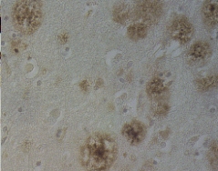IHC-P using ab1906 showing senile plaques. (x200)