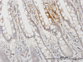 Immunoperoxidase staining of Apolipoprotein F in formalin fixed, paraffin embedded human small intestine tissue using ab77452 at 3 µg/ml.