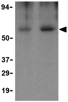 Lane 1 :  Anti-Apolipoprotein J antibody (ab37172) at 0.5 µg/mlLane 2 :  Anti-Apolipoprotein J antibody (ab37172) at 1 µg/mlLane 1 : Human brain tissue lysateLane 2 : Human brain tissue lysateLysates/proteins at 15 µg per lane.Secondaryanti-rabbit IgG HRP at 1/10000 dilution