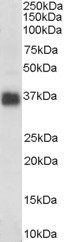 Anti-Apolipoprotein J antibody (ab39991) at 0.3 µg/ml + Human Colon lysate, 35 µg protein in RIPA buffer. Primary incubation was 1 hour. Detected by chemiluminescence.