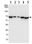 All lanes : Anti-Apoptosis inhibitor 5 antibody (ab99307) at 0.04 µg/mlLane 1 : HeLa whole cell lysate at 50 µgLane 2 : HeLa whole cell lysate at 15 µgLane 3 : HeLa whole cell lysate at 5 µgLane 4 : 293T whole cell lysate at 50 µgLane 5 : NIH 3T3 whole cell lysate at 50 µgdeveloped using the ECL technique