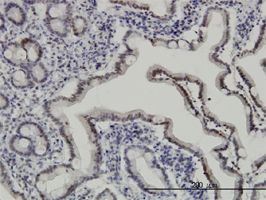 Apoptosis inhibitor 5 antibody (ab56392) used in immunohistochemistry at 3ug/ml on formalin fixed and paraffin embedded human small Intestine.