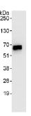 anti Apoptosis inhibitor 5 (ab99307), at 0.4 µg/ml, staining Apoptosis inhibitor 5 in HeLa whole cell lysate immunoprecipitated using ab99308 at 3 µg/mg lysate (1 mg/IP; 20% of IP loaded/lane). Detection: Chemiluminescence with an exposure time of 1 second.