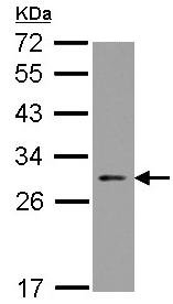Anti-Apoptosis repressor with CARD antibody (ab126238) at 1/1000 dilution + HeLa whole cell lysate at 30 µg