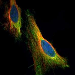 Confocal immunofluorescence analysis of ab126238, at a 1/500 dilution, staining Apoptosis repressor with CARD in paraformaldehyde fixed HeLa cells (Green). Alpha-tubulin filaments were labeled with another antibody (Red) at a 1/2000 dilution.