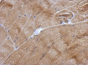 ab126238, at a 1/500 dilution, staining Apoptosis repressor with CARD in paraffin embedded muscle tissue by Immunohistochemistry.