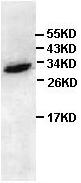 Anti-Apoptosis repressor with CARD antibody (ab90082) at 1/500 dilution + HeLa lysate