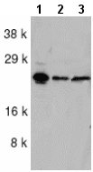 All lanes : Anti-Apoptosis repressor with CARD antibody (ab2002) at 1/1000 dilutionLane 1 : HeLa whole cell lysateLane 2 : KB whole cell lysateLane 3 : A549 whole cell lysateObserved band size : 25 kDa (why is the actual band size different from the predicted?)
