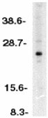 Anti-Apoptosis repressor with CARD antibody (ab2003) at 1/500 dilution + HeLa whole cell lysateObserved band size : 25 kDa (why is the actual band size different from the predicted?)