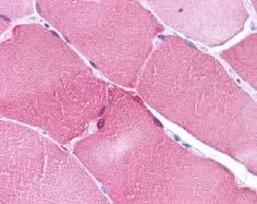 ab62149 at 5µg/ml, staining Human Apoptosis repressor with CARD in skeletal muscle by IHC-P.