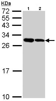 All lanes : Anti-Apoptosis repressor with CARD antibody (ab137816) at 1/1000 dilutionLane 1 : H1299 whole cell lysateLane 2 : HepG2 whole cell lysateLysates/proteins at 30 µg per lane.