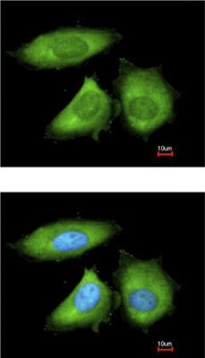 Immunofluorescent analysis of HeLa cells labelling Apoptosis repressor with CARD with ab137816 at 1/200 dilution. Lower image is costained with Hoechst 33342.