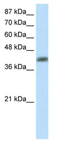 Anti-Aprataxin antibody (ab66861) at 2.5 µg/ml + NCI-H226 cell lysate at 10 µgSecondaryHRP conjugated anti-Rabbit IgG at 1/50000 dilution