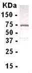 E coli-derived fusion protein as test antigen. Affi-pure IgY dilution: 1/2000, Goat anti-IgY-HRP dilution: 1/1000. Colorimetric method for signal development.