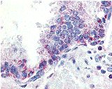 Immunohistochemistry of APRIL in human prostate tissue with APRIL antibody at 10 µg/ml.