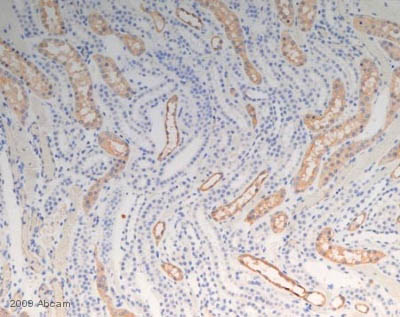 ab15080 staining Aquaporin 1 in human kidney tubule tissue sections by IHC-P (formaldehyde-fixed paraffin-embedded sections). Tissue samples were fixed with formaldehyde. Antigen retrieval was by heat mediation in citrate buffer (20 minutes at 100°C). Samples were incubated with primary antibody 1/2000(background reducer diluent) for 20 minutes at 25°C. An undiluted HRP polymer Goat anti mouse/rabbit monoclonal IgG was used as secondary antibody.See Abreview