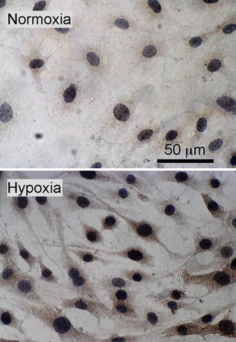 ab15080 staining Aquaporin 1 in rat 9L (gliosarcoma) cells by Immunocytochemistry.Cells were kept under normoxic conditions (upper panel) or exposed to hypoxia (lower panel). Cells were then fixed with paraformaldehyde, permeabilized in 0.1% Triton X-100 in PBS, before being blocked with 10% fetal calf serum + 1 mg/ml BSA in PBS overnight at 4°C. Samples were subsequently incubated with primary antibody (1/500 in diluent) and a peroxidase-conjugated goat anti-rabbit IgG was used as a secondary antibody. Samples were stained using DAB and counter-stained with hematoxylin.