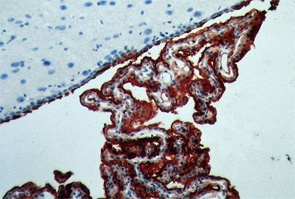Immunohistochemical staining of aquaporin 1 in rat brain.