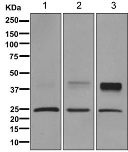 All lanes : Anti-Aquaporin 1 antibody [EPR11588(B)] (ab168387) at 1/10000 dilutionLane 1 : Human fetal kidney lysateLane 2 : Human fetal lung lysate Lane 3 : Human fetal heart lysateLysates/proteins at 10 µg per lane.SecondaryGoat anti-rabbit HRP at 1/2000 dilution