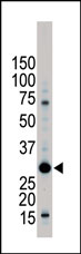 Anti-14-3-3 alpha + beta antibody (ab37550) at 1/100 dilution + Jurkat cell lysate