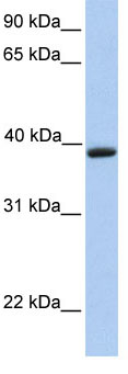 Anti-Aquaporin 10 antibody (ab81179) at 1 µg/ml + Jurkat Cell Lysate at 10 µg