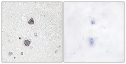 ab111346 at 1/50 dilution staining Aquaporin 2 in Paraffin-embedded Human Brain tissue by Immunohistochemistry. The image on the right is treated with the synthesized phosphopeptide.