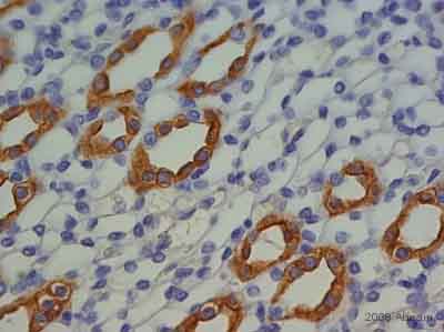 ab15081 staining Aquaporin 2 in rat kidney tissue section by IHC(P). Tissue underwent fixation in formalin, embedded in paraffin, heat mediated antigen retrieval in 10mM EDTA buffer pH 8.0 and blocking in 5% serum for 20 minutes at 20°C. The primary antibody, diluted 1/300 in TBSTween and incubated with sample for 1 hour at 20°C. A HRP conjugated goat polyclonal to rabbit was used undiluted as the secondary.   See Abreview