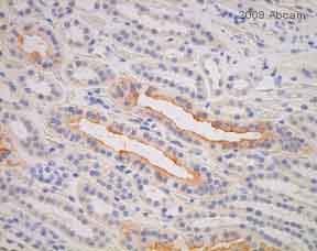 ab15081at a 1/250 dilution staining Aquaporin 2 in human kidney tissue by Immunohistochemistry (formalin fixed, paraffin embedded sections), incubated for 20 minutes at 25°C. Heat mediated retrieval step performed using EDTA at 100°C for 20 minutes. Secondary used undiluted monoclonal Goat anti-rabbit, Leica Refine, HRP polymer.See Abreview