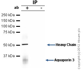 Aquaporin 3 was immunoprecipitated using 0.5mg Mouse Kidney extract, 5µg of Rabbit polyclonal to Aquaporin 3 and 50µl of protein G magnetic beads (+). No antibody was added to the control (-). The antibody was incubated under agitation with Protein G beads for 10min, Mouse Kidney extract lysate diluted in RIPA buffer was added to each sample and incubated for a further 10min under agitation.Proteins were eluted by addition of 40µl SDS loading buffer and incubated for 10min at 70oC; 10µl of each sample was separated on a SDS PAGE gel, transferred to a nitrocellulose membrane, blocked with 5% BSA and probed with ab125219.Secondary: Mouse monoclonal [SB62a] Secondary Antibody to Rabbit IgG light chain (HRP) (ab99697).Band: 31kDa: Aquaporin 3.