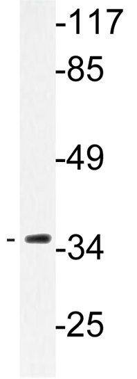 Anti-Aquaporin 5 antibody (ab134687) at 1/500 dilution + HUVEC cell extracts at 30 µg