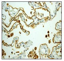 ab92320 at 1/100 dilution, staining Aquaporin 5 in paraffin embedded Human lung tissue 