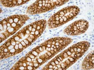 ab92320 showing positive staining in Normal colon tissue.