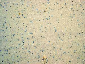 ab92320 showing negative staining in Normal brain tissue.