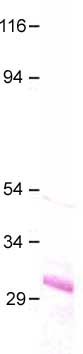 Anti-Aquaporin 7 antibody (ab32826) at 1/500 dilution + APQ7 control sample